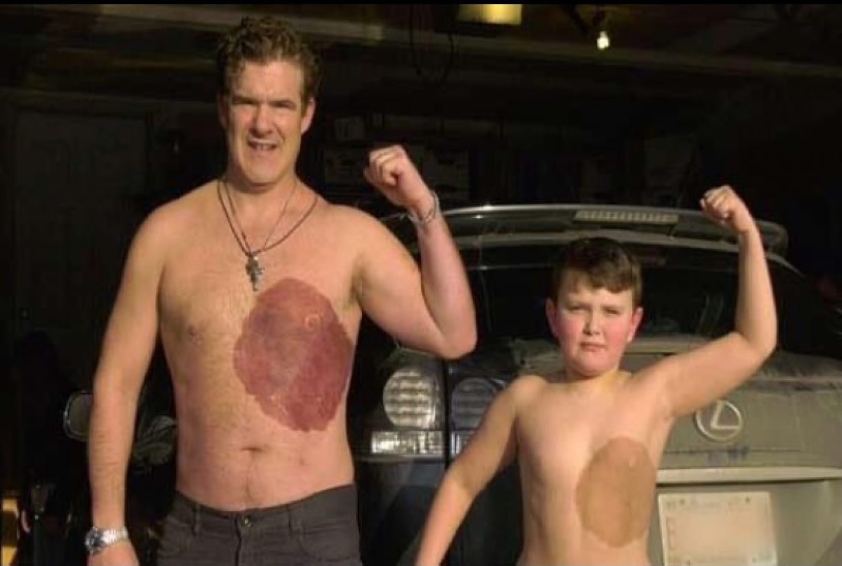 Pai tatua no seu corpo marca de nascença do Filho