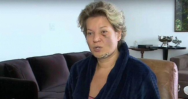 Deputado, Joice Hasselmann aciona Polícia Legislativa após acordar com fraturas e ensanguentada